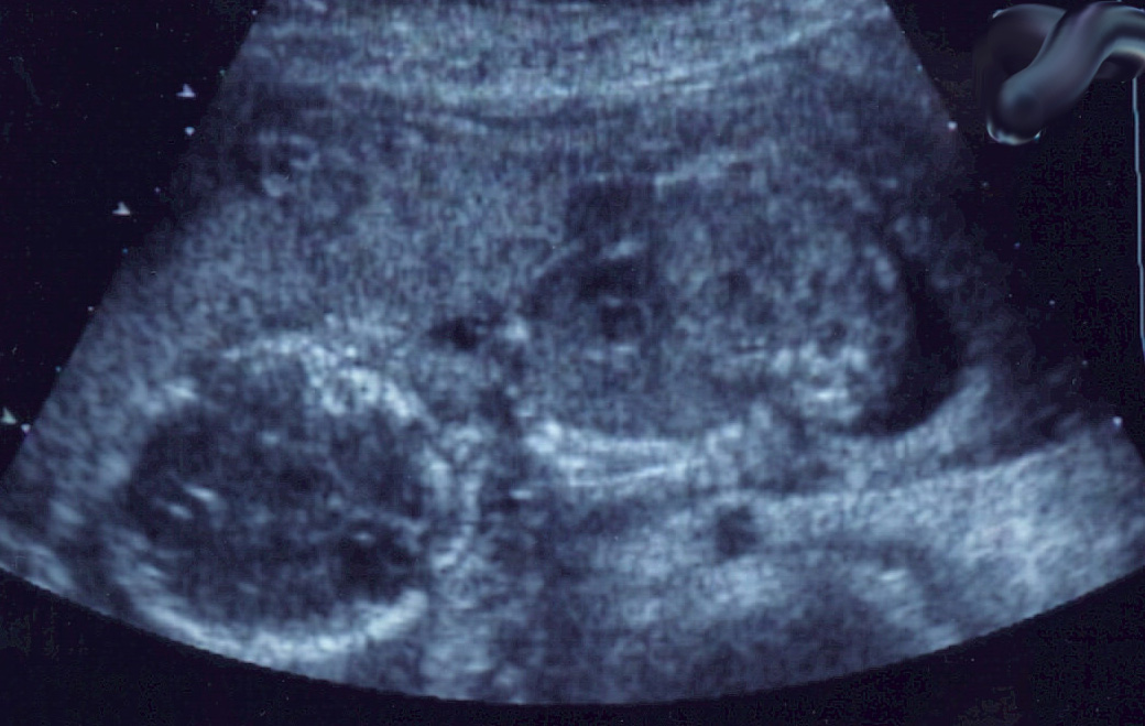 Edelet Ultrasound